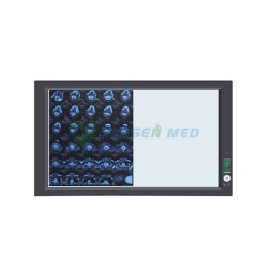Led X-Ray Film Viewer Radiation Accessories