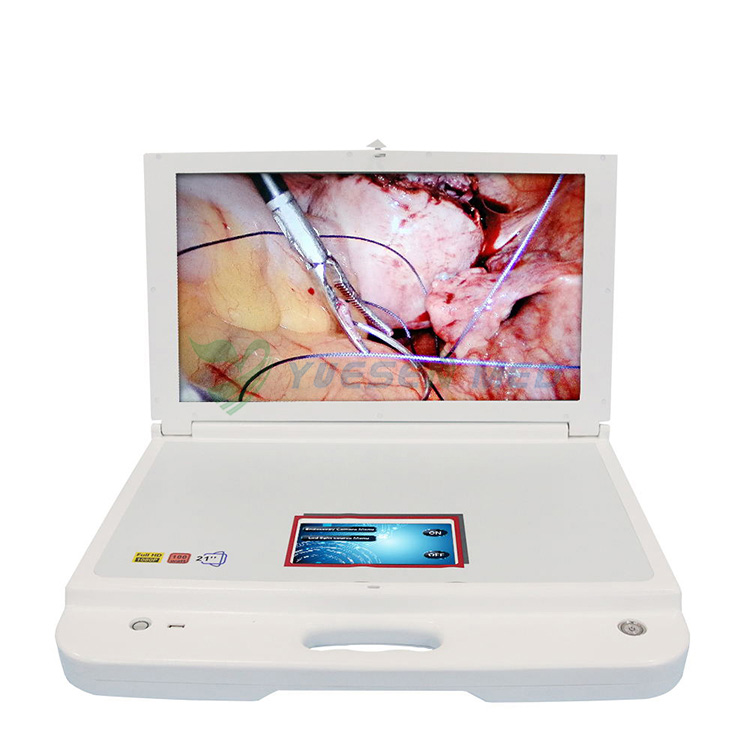 Caméra endoscopique endoscopique médicale portable chirurgie ORL HDMI USB  Full H