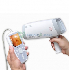 Gynecology examination digital optical colposcope portable video vaginal colposcope