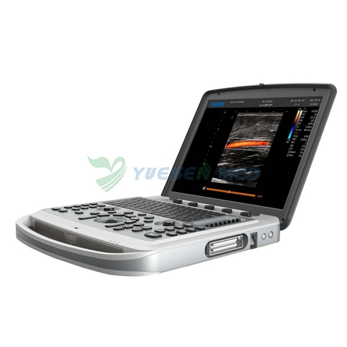 Chison SonoBook 6 4D Ultrasound Machine Portable Ultrasound