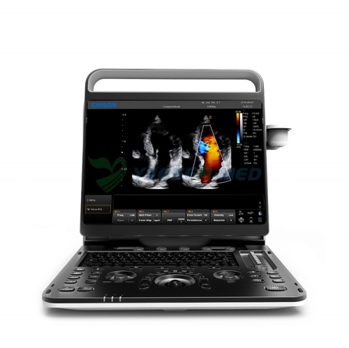 Escáner de ultrasonido Doppler color 4D portátil Chison Ebit 60
