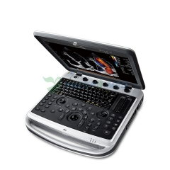 Máquina de ultrassom para laptop inteligente Chison Sonobook 9