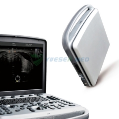 Máquina de ultrasonido Chison SonoBook 6 4D Ultrasonido portátil