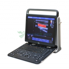 Chison Ebit 60 Portable 4D Color Doppler Ultrasound Scanner