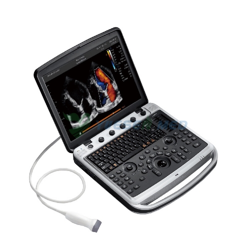 Мощный ультразвуковой аппарат с цветным допплером Sonobook