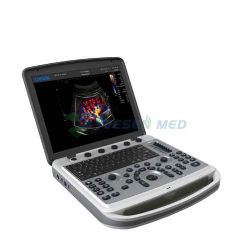 Máquina de ultrassom para笔记本电脑智能奇森Sonobook 9