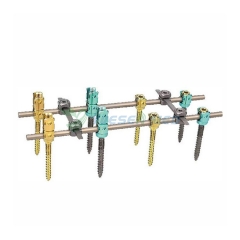 5.5mm Spinal Pedicle Screw System