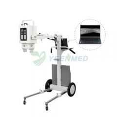 YSX050-C del sistema de radiografía veterinaria portátil digital