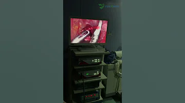 YSENMED full HD Endoscope Camera System YSGW80C-N In Surgery