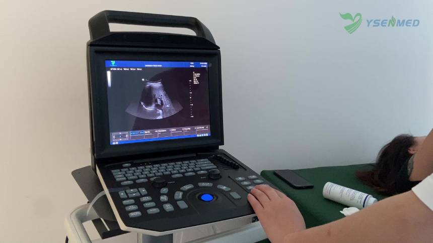 Kidney scanning in color mode with YSENMED portable color ultrasound machine YSB-M5