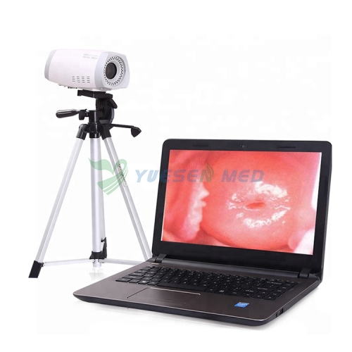 Colposcope optique numérique d'examen gynécologique Colposcope vaginal visuel portatif