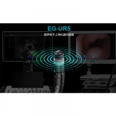 Sonoscape EG-UR5 تنظير الصدى الشعاعي
