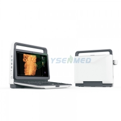 Escáner de ultrasonido Doppler color 4D portátil rentable YSB-M70