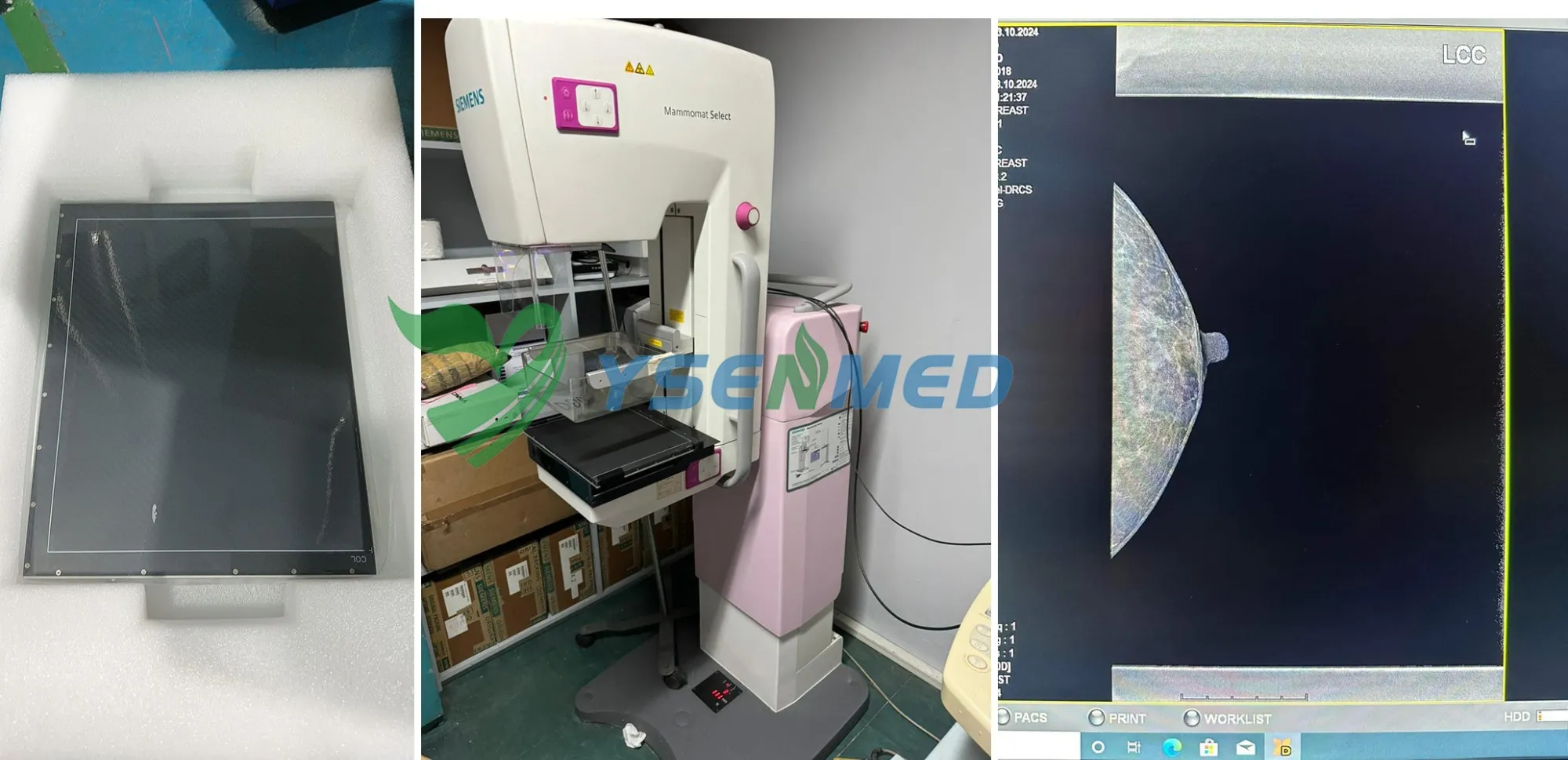 Qualidade de imagem do detector de mamografia YSFPD-R1012C altamente reconhecida pelo médico filipino