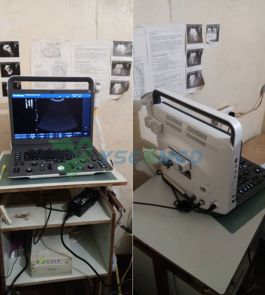El ecógrafo portátil SonoScape E1 funciona bien en un hospital de Zambia.