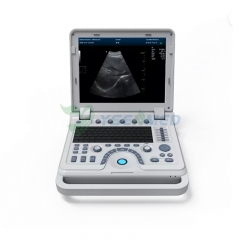 YSB1700B Portable 4D Color Doppler Ultrasonic Diagnostic System