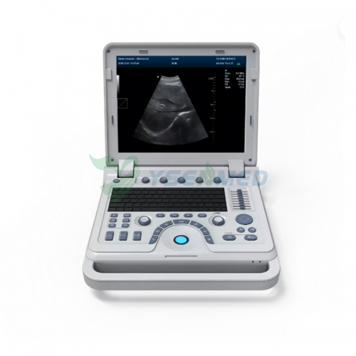 Système de diagnostic à ultrasons Doppler couleur 4D portable YSB1700B