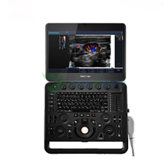 Portable 4D Color Doppler Ultrasound Machine SonoScape X5