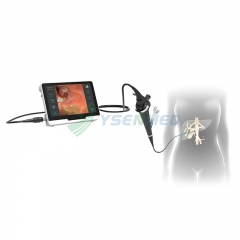 YSNJ-CH1331 Flexible Video Choledochoscope