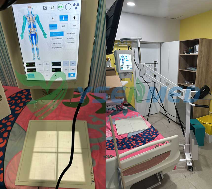 Système de radiographie numérique portable YSX056-PE installé dans une clinique au Venezuela.