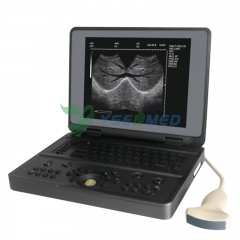 YSB3000W Full Digital Ultrasound Imaging System