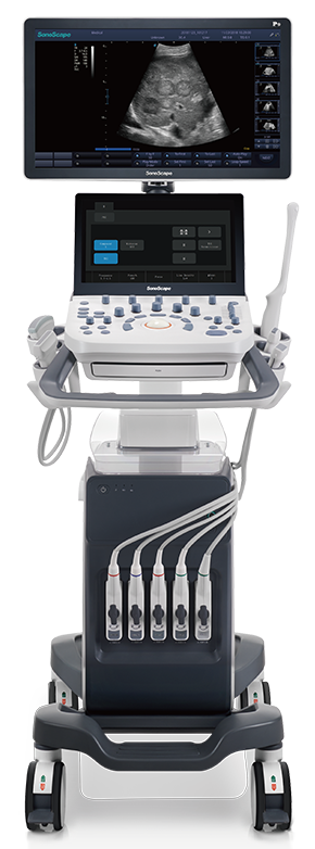 Ultrasound Scanner