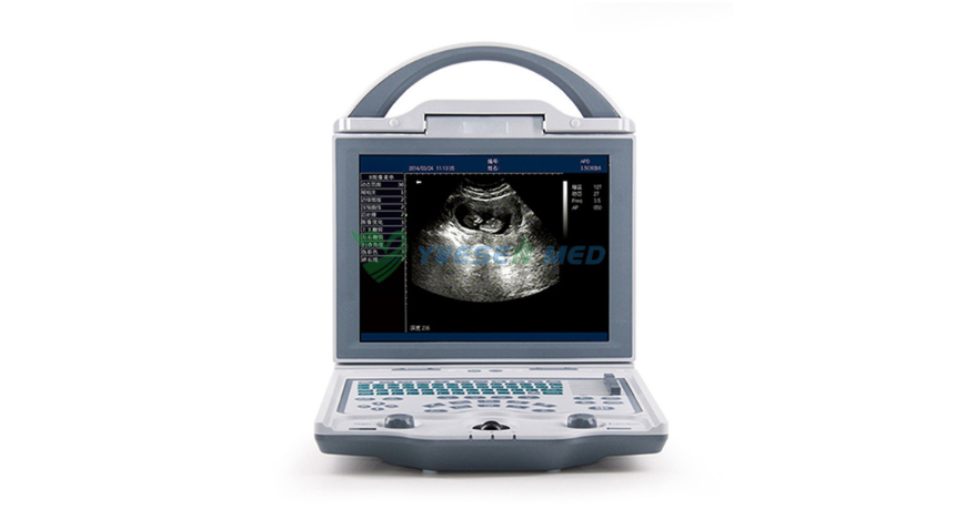 Why This Portable Ultrasound Machine Feels Like a Clinic You Can Carry in One Hand