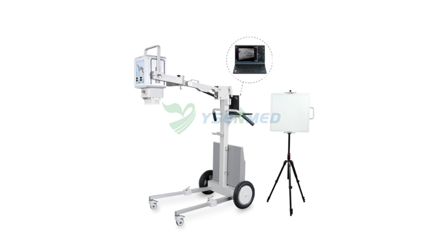 Need Speed and Precision? Meet the 5.6kW Digital Portable X-ray Unit with 8-Second Imaging