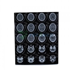 Película térmica seca para rayos X médicos YSX-JP