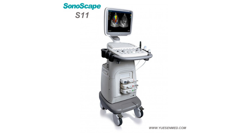 ¿Busca un ecógrafo Doppler color tipo carro que ofrezca más por menos? Conozca el SonoScape S11.