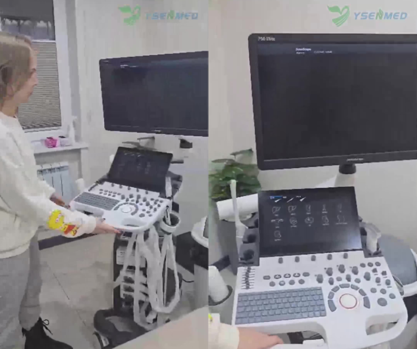 Uzbekistan Doctor Chooses SonoScape P50 Elite for a New Clinic, Praising Outstanding Image Quality