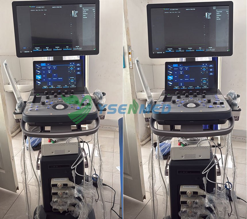 Comentarios de clientes de Zimbabue: Un radiólogo elogia la calidad de imagen del sistema de ultrasonido Doppler color YSB-VIV20.