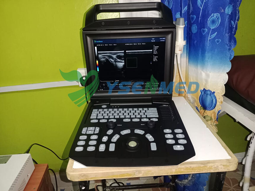 Dr Fredrick in Kenya Chooses YSB-M5 Portable Ultrasound for Everyday Clinical Diagnosis