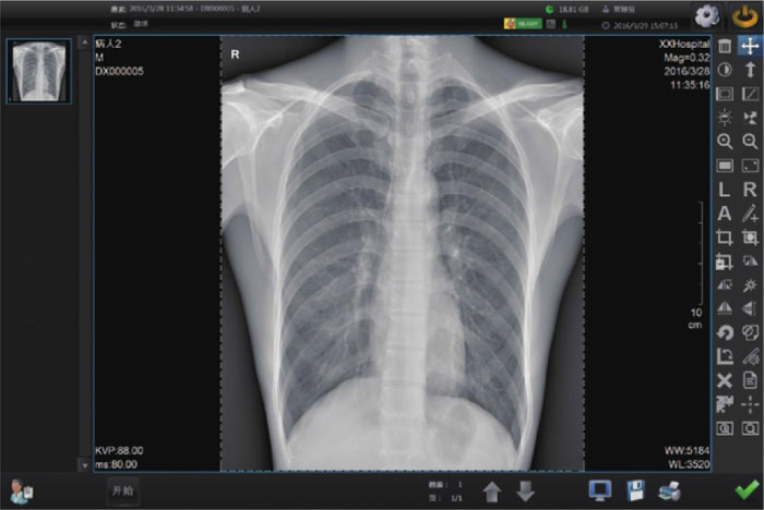DR Detector Price - Digital Radiography Detector Software