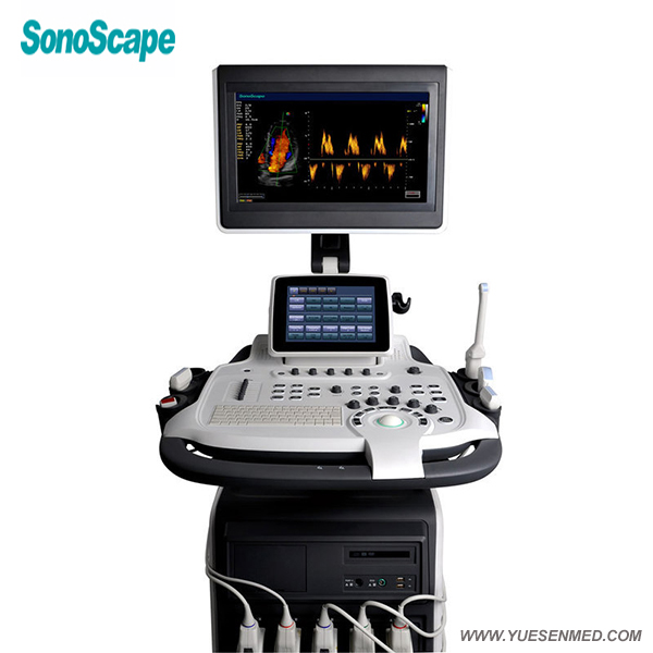 4D彩色多普勒超声扫描仪价格Sonoscape S40