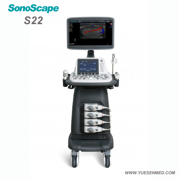 SonoScape S22 - Sonoscape Trolley color doppler ultrasound price
