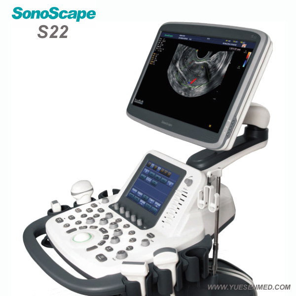 Trolley doppler couleur à ultrasons SonoScape S22 prix