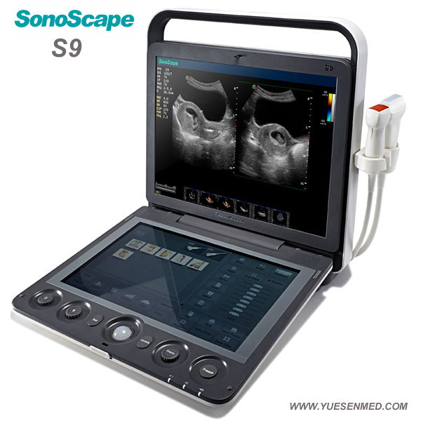 3D 4D color doppler ultrasound sonoscape S9