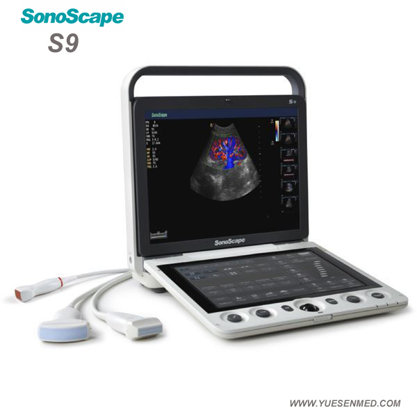 3D 4D color doppler ultrasound sonoscape S9