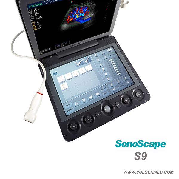 3D 4D color doppler ultrasound sonoscape S9