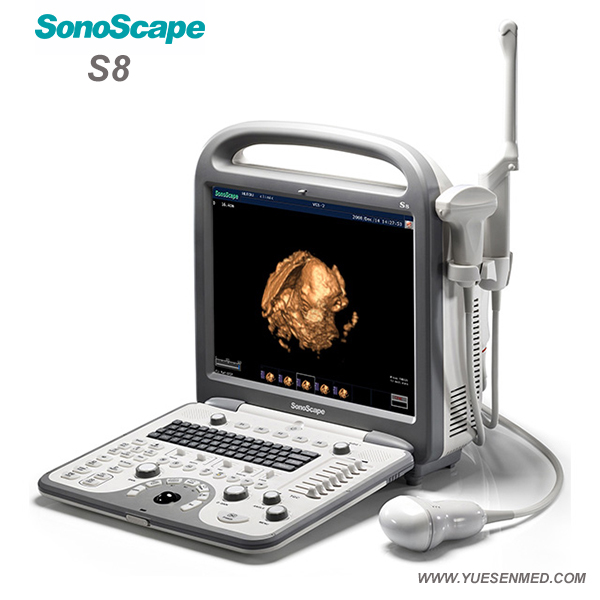 Couleur Portable vétérinaire échographie Doppler S8V Sonoscape