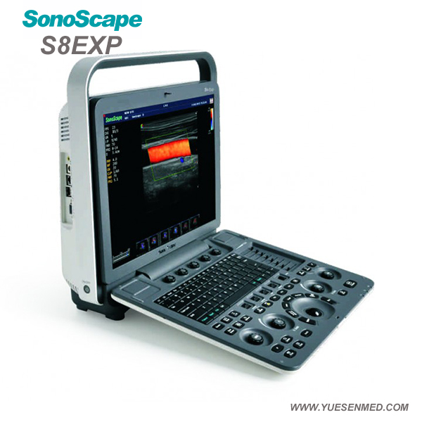 Sonoscape S8Exp- Sonoscape便携式颜色多普勒超声S8EXP价格 -  Sonoscape超声待售