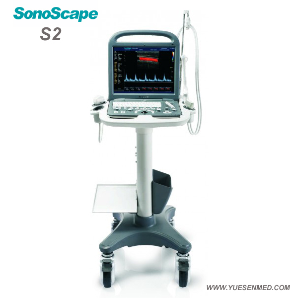 Sonoscape Portable Color Doppler Ultrasound S2 For Sale