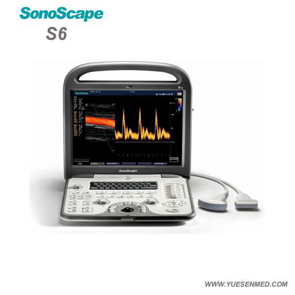 Sonoscape S6 - Ultrasons Doppler couleur portatif Sonoscape S6 Prix