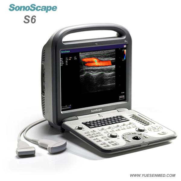 Sonoscape S6 - Ultrasons Doppler couleur portatif Sonoscape S6 Prix