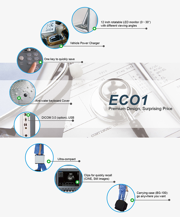 CHISON ECO1 User-friendly and Modern Design