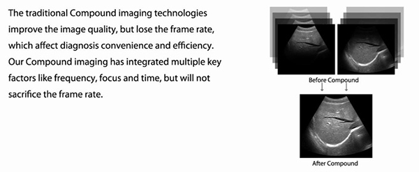 CHISON Q5 COMPOUNDING TECHNOLOGY