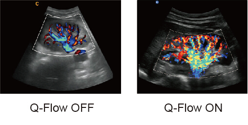 CHISON QBit5 Price - Chison Color doppler ultrasound QBit5 image