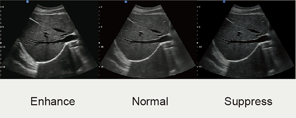 CHISON QBit5 Price - Chison Color doppler ultrasound QBit5 image