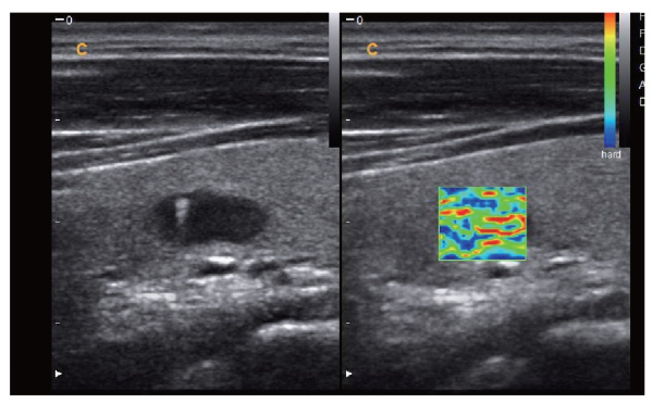 Chison I8 Price - Chison ultrasound portable image